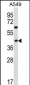 C109B Antibody (C-term)